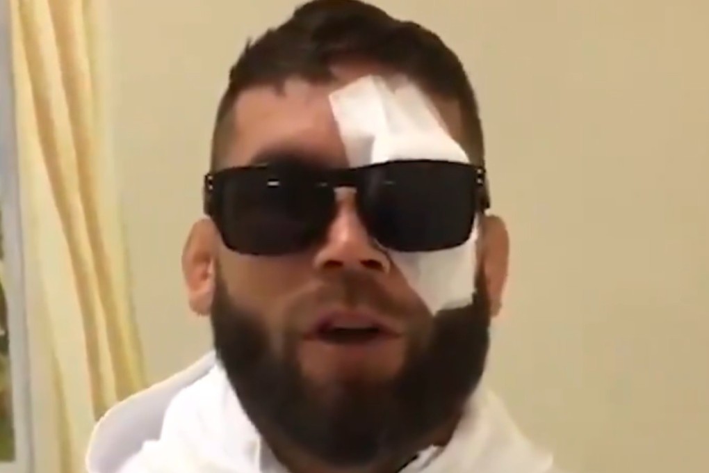 Jeremy Stephens talks to ESPN with a bandage on his left eye after the fight. Photo: Twitter/@karynbryant