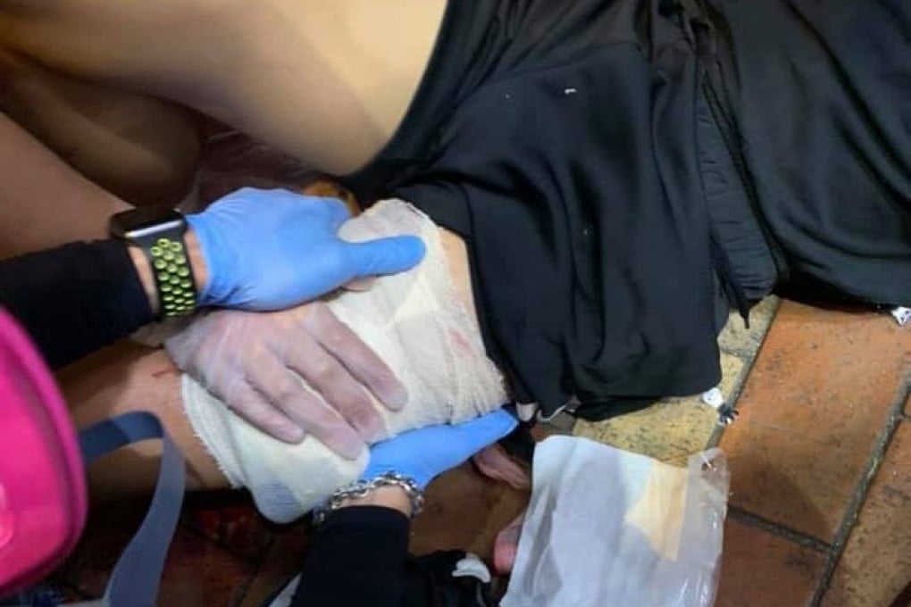 The 14-year-old boy is in a stable condition after an operation in Tuen Mun Hospital. Photo: Handout