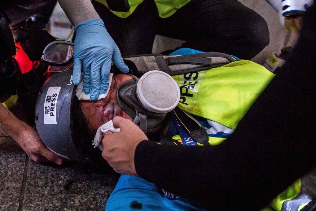 Indonesian journalist Veby Mega Indah was shot in the face by a riot police officer while covering anti-government protests in Hong Kong. Photo: AFP