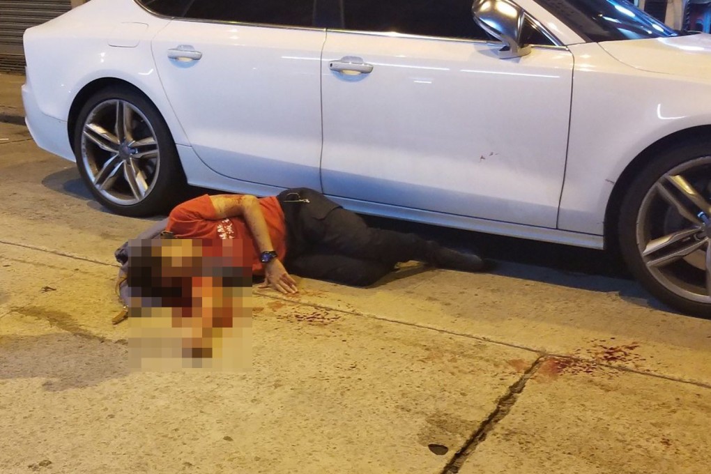 Jimmy Sham is pictured after Wednesday’s attack. Photo: Facebook