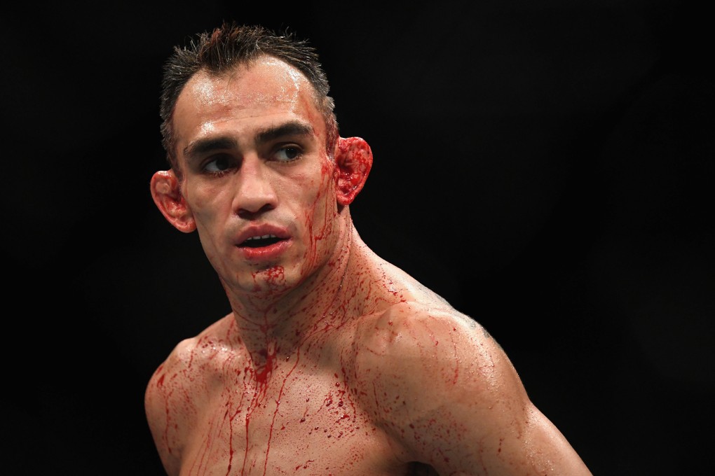 Tony Ferguson looks on while competing against Anthony Pettis in their lightweight bout at UFC 229. Photo: AP