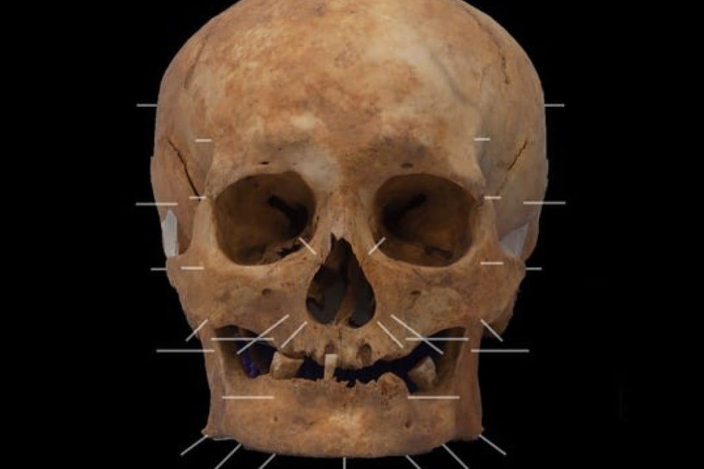 The skull was dug up at the site of the Aberdeen Art Gallery in Aberdeen, Scotland amid construction of a new development on the site. Photo: Aberdeen Art Gallery