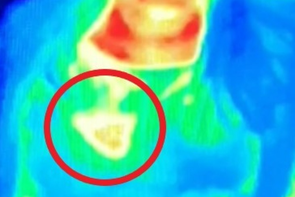 The circled area shows one of Bal Gill’s breasts glowing yellow while trying the thermal camera exhibit in Edinburgh. Photo: Bal Gill