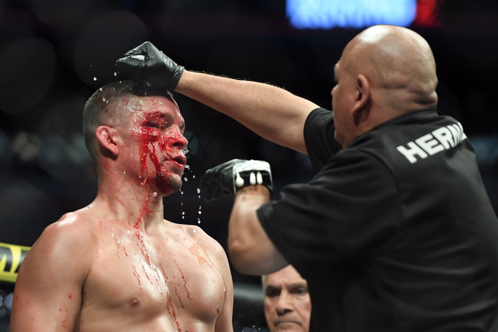 Nate Diaz gets treatment during his fight against Jorge Masvidal at UFC 244 at Madison Square Garden. Photo: USA TODAY Sports