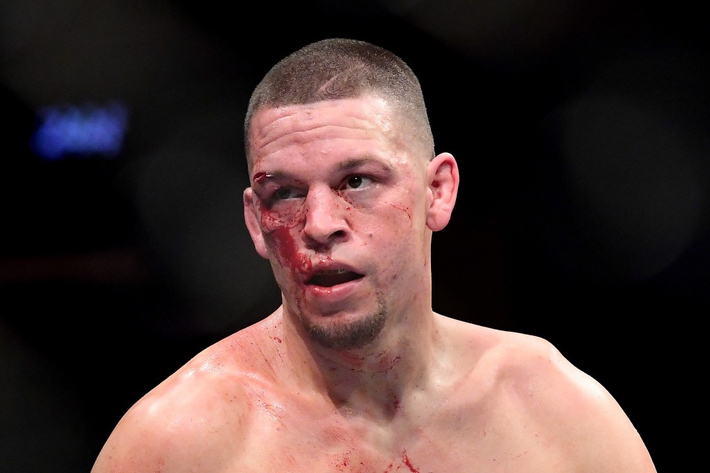 Nate Diaz wants to run it back with Jorge Masvidal after the doctor called their UFC 244 fight off. Photo: AFP