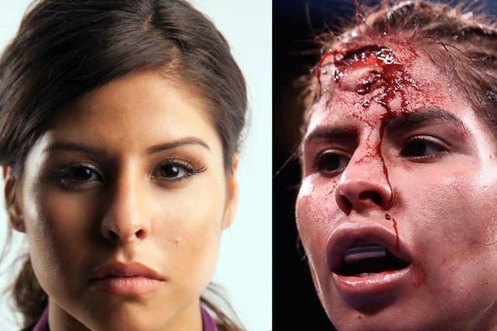 Marlen Esparza suffered a gruesome injury during her women's flyweight title bout in Las Vegas. Photos: Facebook