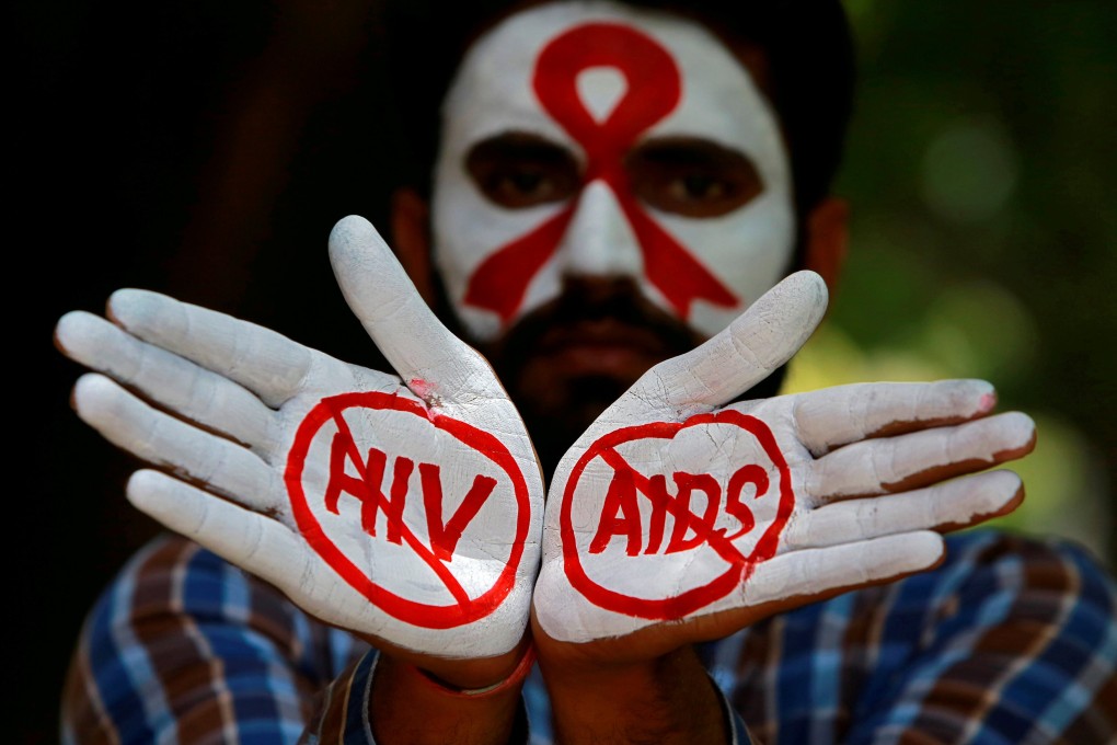 A student displays messages painted on his hands during an awareness campaign to mark the International Aids Candlelight Memorial in Chandigarh, India, in May 2018. Photo: Reuters