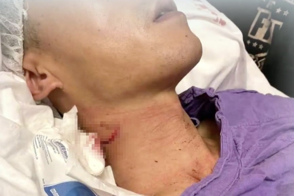 A police officer slashed in the neck by an anti-government protester faces months of speech therapy and will likely suffer permanent damage to his voice. Photo: TVB News