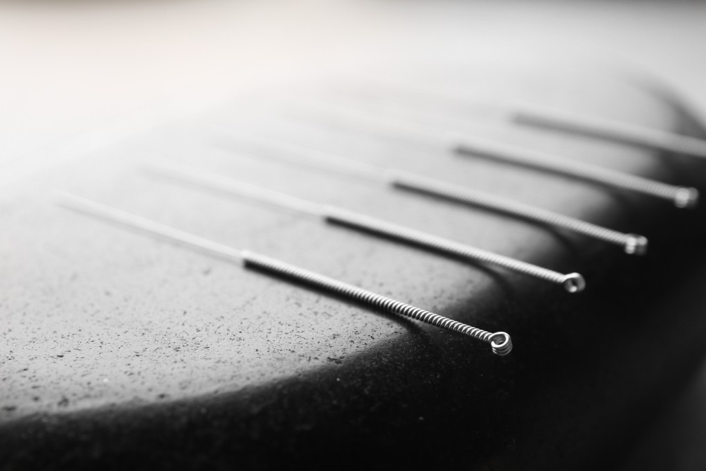 The treatment was inspired by the traditional Chinese treatment. Photo: Shutterstock