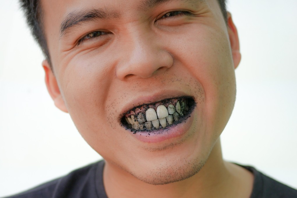 Charcoal oral care products claim to have anti-fungal and antibacterial properties, but there’s no proof of that, says Dr Sherina Daryanani, a Singapore-based dentist. Photo: Shutterstock