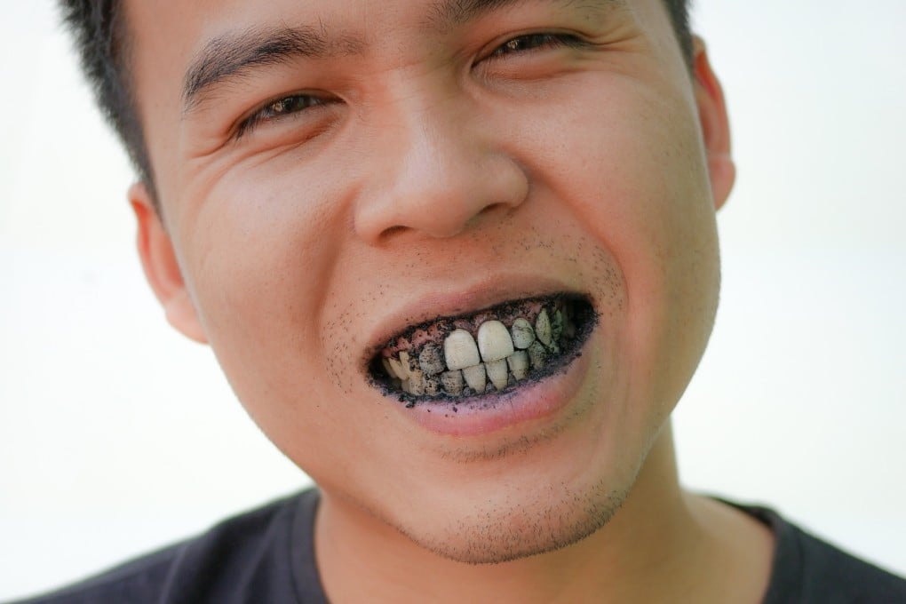 Charcoal oral care products claim to have anti-fungal and antibacterial properties, but there’s no proof of that, says Dr Sherina Daryanani, a Singapore-based dentist. Photo: Shutterstock