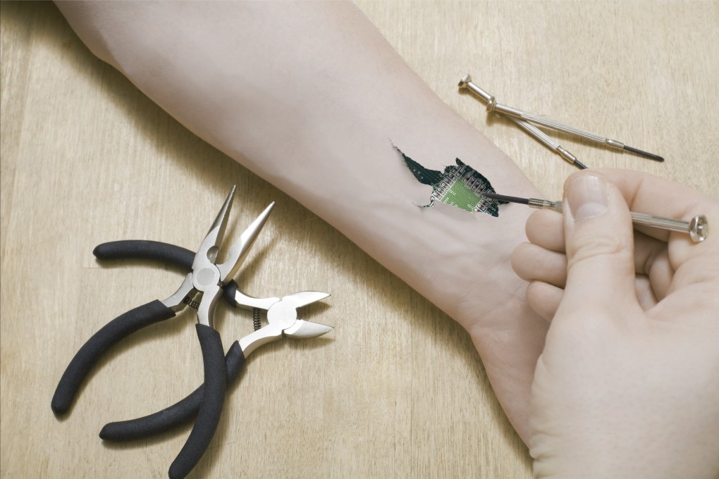 Implants such as a chip in your hand or wrist that could send messages and open your front door are one of the more extreme visions of biohackers. Photo: Shutterstock