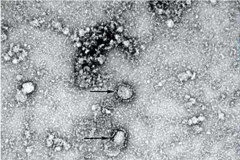 The first close-up images of the Wuhan coronavirus were released on Friday. Photo: Chinese Centre For Disease Control And Prevention