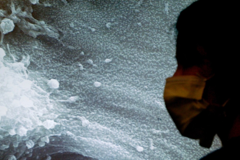 A reporter sits in front a projected image showing Sars-infected cells inspected under a microscope during a news conference in Hong Kong in 2003. The new coronavirus is similar to the one that caused Sars, but they are not identical. Photo: Reuters