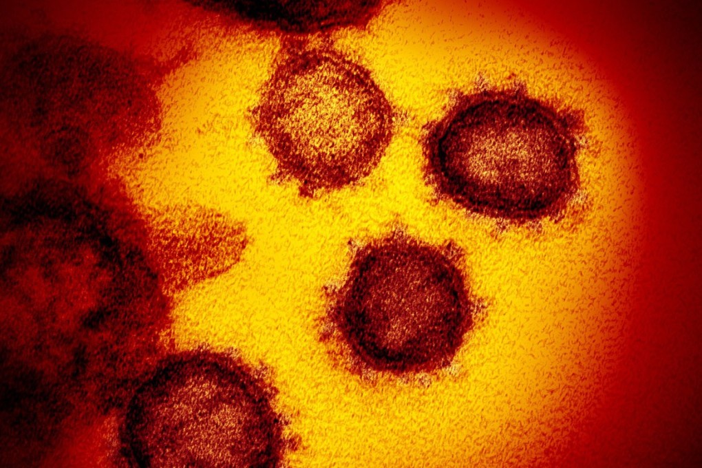An electron microscope image shows the coronavirus emerging from the surface of cells. Photo: Handout