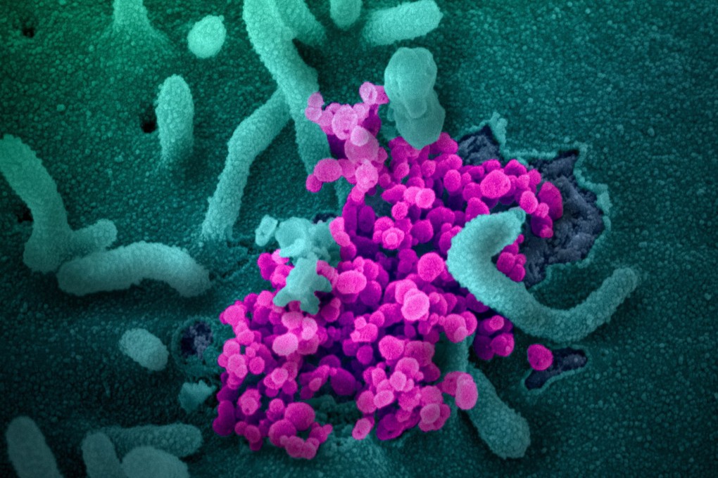 Researchers believe the new coronavirus will continue to mutate as it spreads. Photo: EPA-EFE