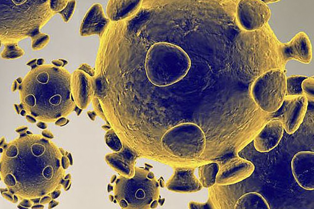 Chinese doctors are using AI to help them diagnose Covid-19 patients. Photo: AFP