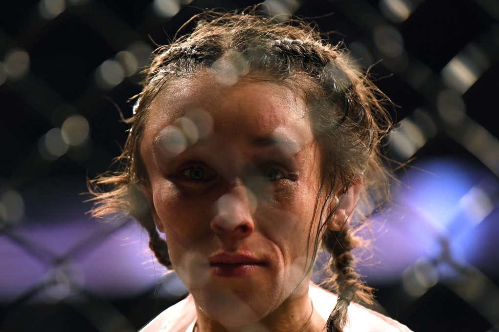 Joanna Jedrzejczyk at the end of her fight against Zhang Weili at UFC 248, where she suffered a huge hematoma on her forehead. Photo: AFP