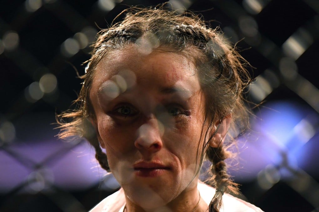 Joanna Jedrzejczyk at the end of her fight against Zhang Weili at UFC 248, where she suffered a huge hematoma on her forehead. Photo: AFP