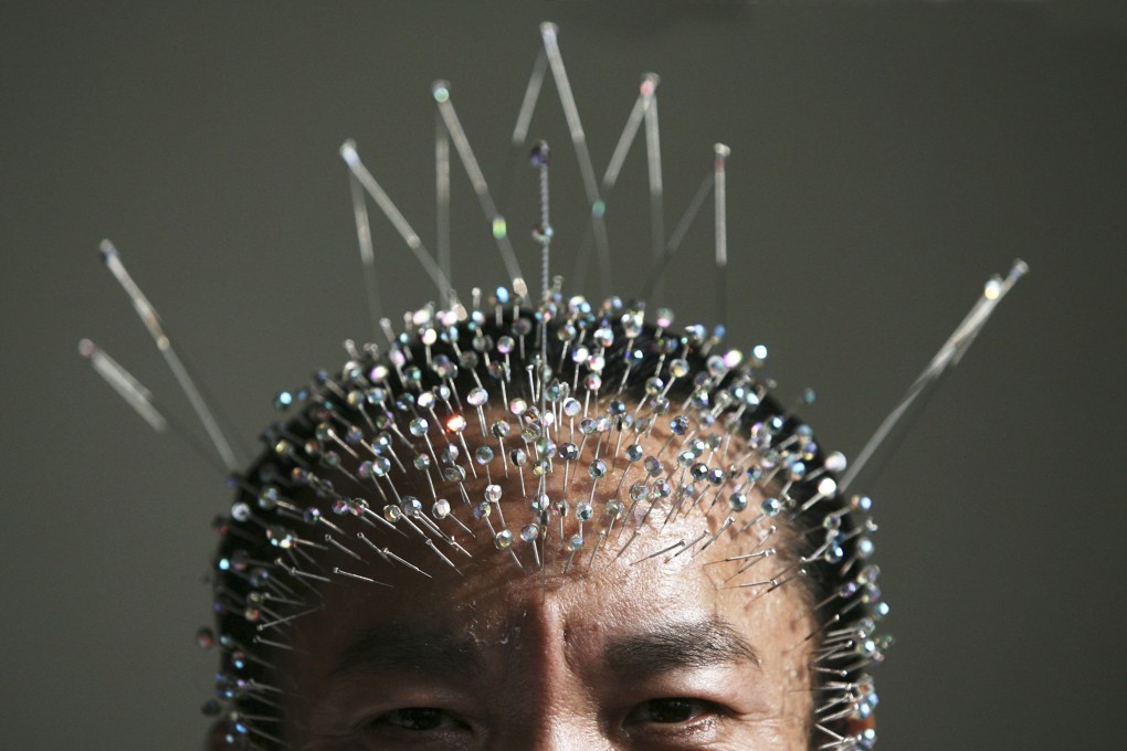 Wei Shengchu holds the record for the most acupuncture needles inserted in a human head. Chinese people have embraced Guinness World Records with gusto. Photo: China Photos/Getty Images