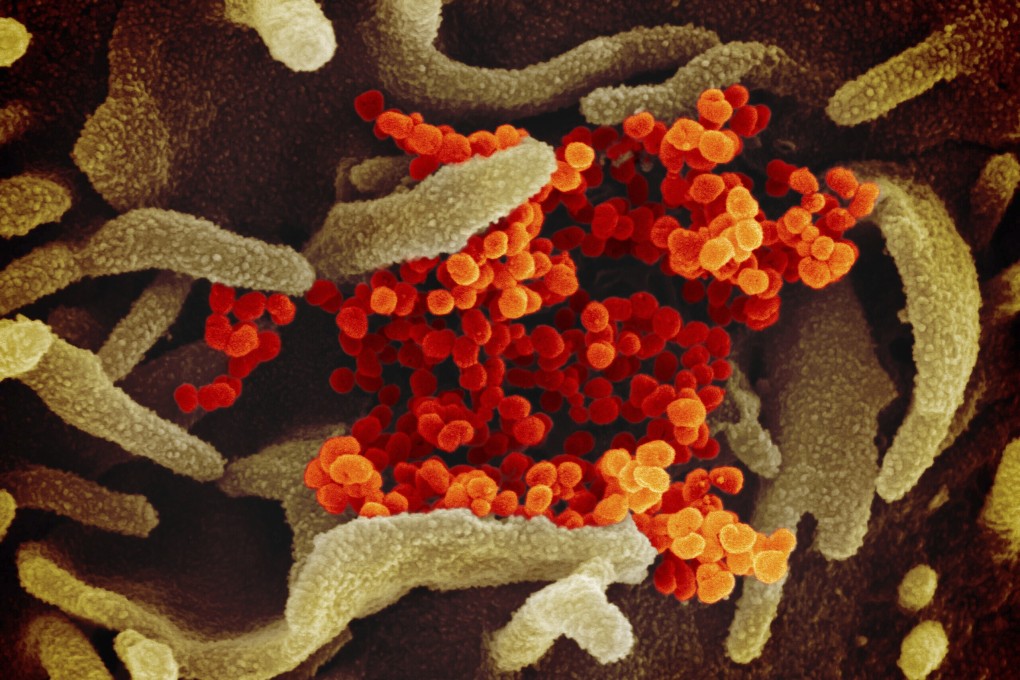 Researchers detected higher viral loads in patients in the first week after symptoms appeared. Photo: AP