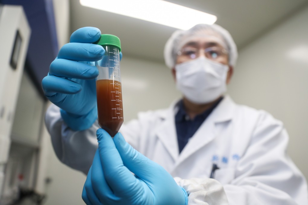 A researcher works on developing a vaccine targeting the new coronavirus in east China’s Shanghai on January 29, 2020. Researchers around the world are racing to develop a vaccine. Photo: Xinhua