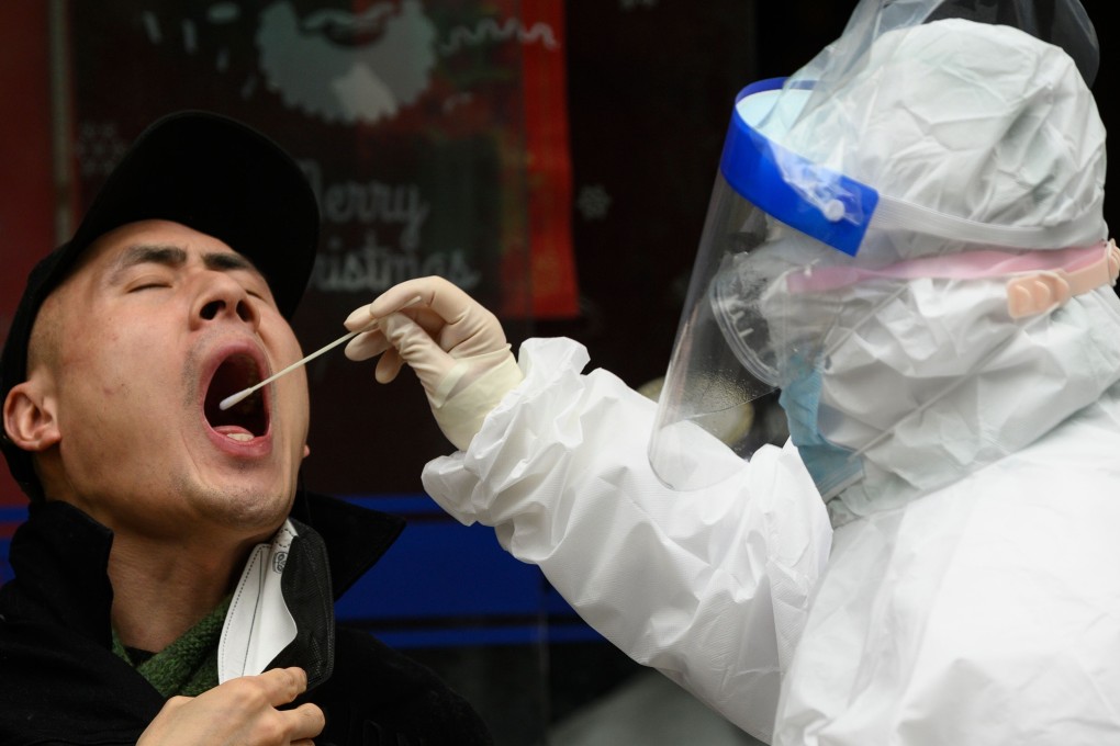 Nasal swab or deep throat saliva samples are collected in a PCR test. Photo: AFP