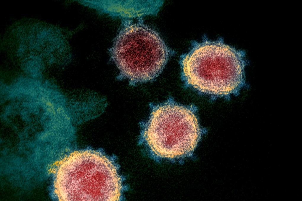 The musical map of the virus aims to identify its weak spots. Photo: AP