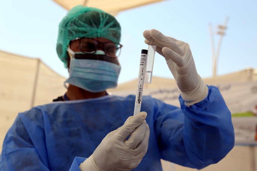 A health official collects virus test samples of people suspected to have the Covid-19 disease in Karachi on April 4, 2020. Photo: EPA-EFE