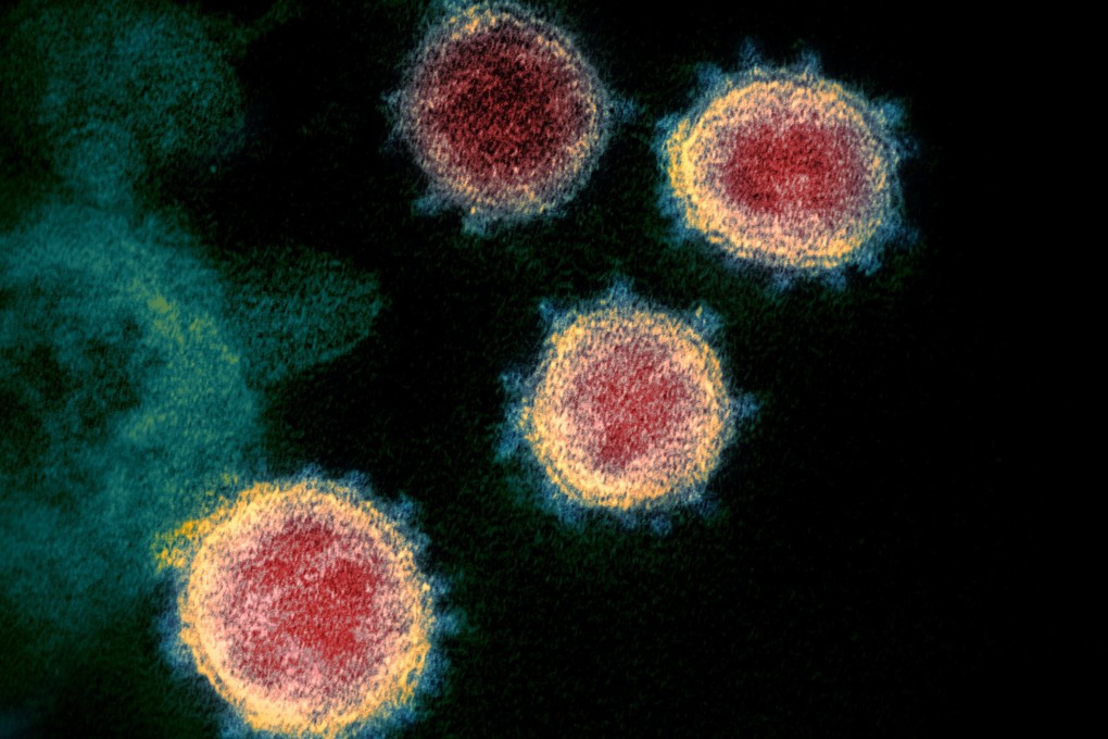 Electron microscope image by the US National Institutes of Health reveals the virus that causes Covid-19. Photo: AP