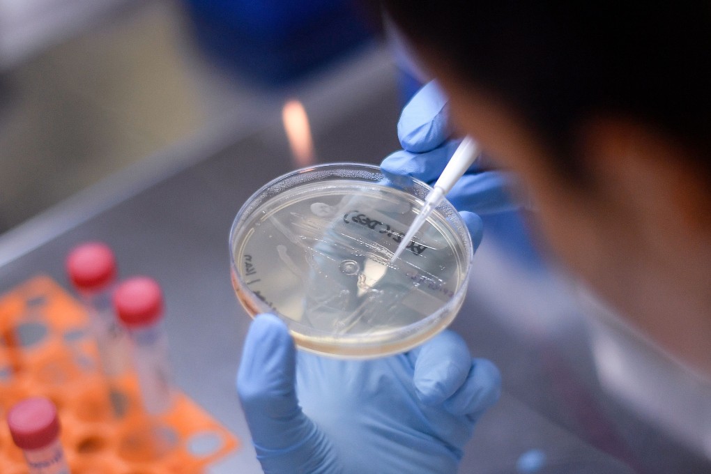 A researcher works on the development of a vaccine against the new coronavirus. Photo: AFP