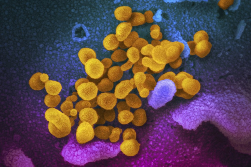An electron microscope image by the US National Institutes of Health shows in yellow the coronavirus that causes Covid-19. Some medical experts suggest any vaccine that is approved might not need to be 100 per cent effective. Photo: NIAID-RML via AP