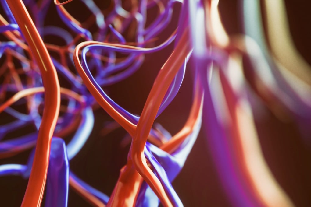 The coronavirus doesn’t just attack the lungs, “it attacks the vessels everywhere”, says the author of a study. Photo: Shutterstock