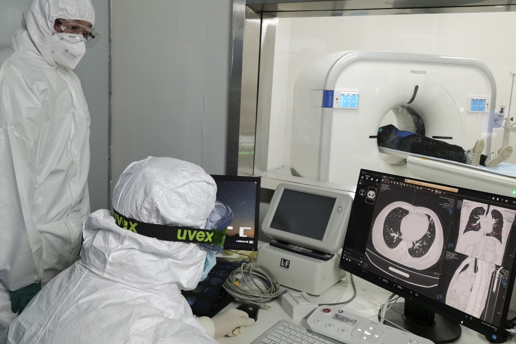 Doctors scan lungs at Huoshenshan temporary hospital built for coronavirus patients in Wuhan on February 9, 2020. Researchers suggest that common testing methods would not detect all traces of the virus. Photo: Xinhua