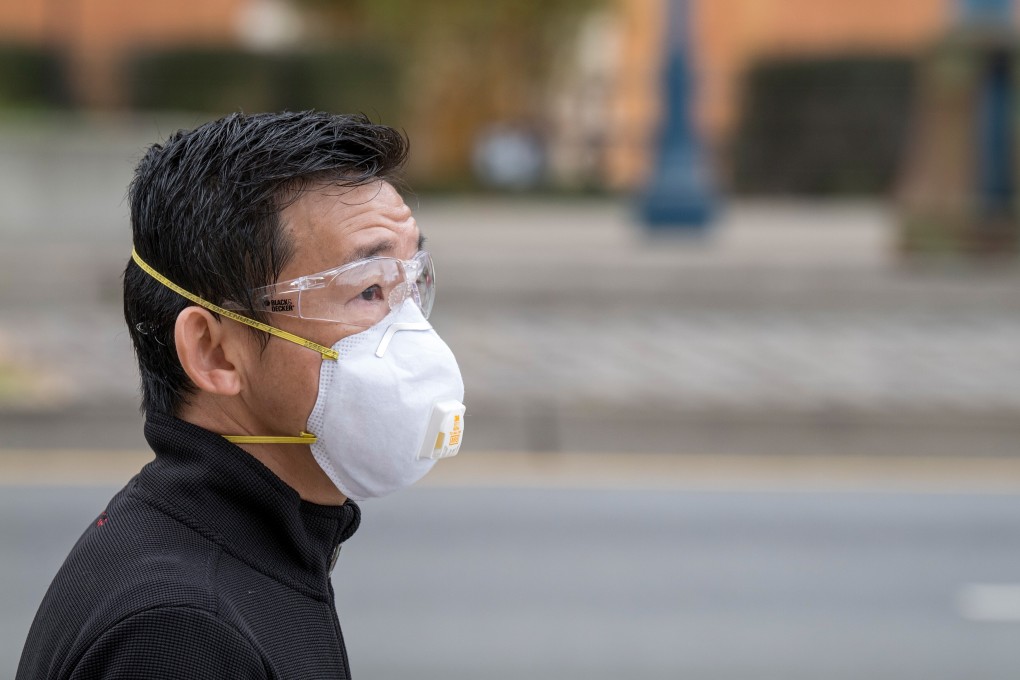 “The enhanced severity in male patients is seen across all ages” study says. Photo: Bloomberg