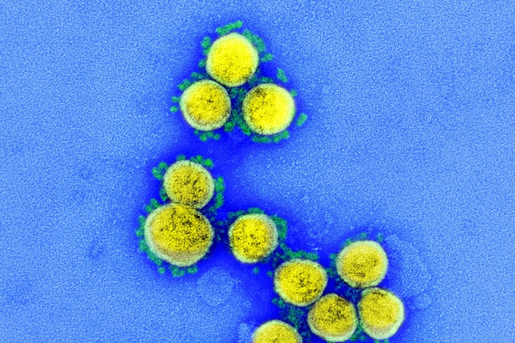 Researchers identified 13 mutations in the spike protein of the Sars-CoV-2 virus. Photo: EPA-EFE