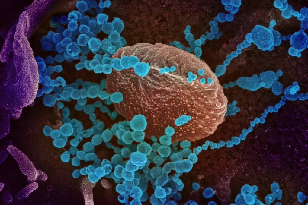 A scanning electron microscope image shows the new coronavirus (round blue objects) emerging from the surface of cells cultured in the lab. Image: NIH via EPA-EFE