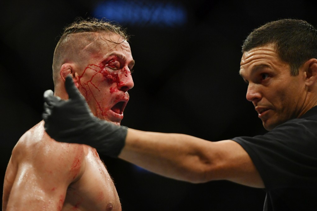 Referee Jason Herzog calls over the doctor as Niko Price struggles to see out of his eye at UFC 249. Photo: USA TODAY Sports