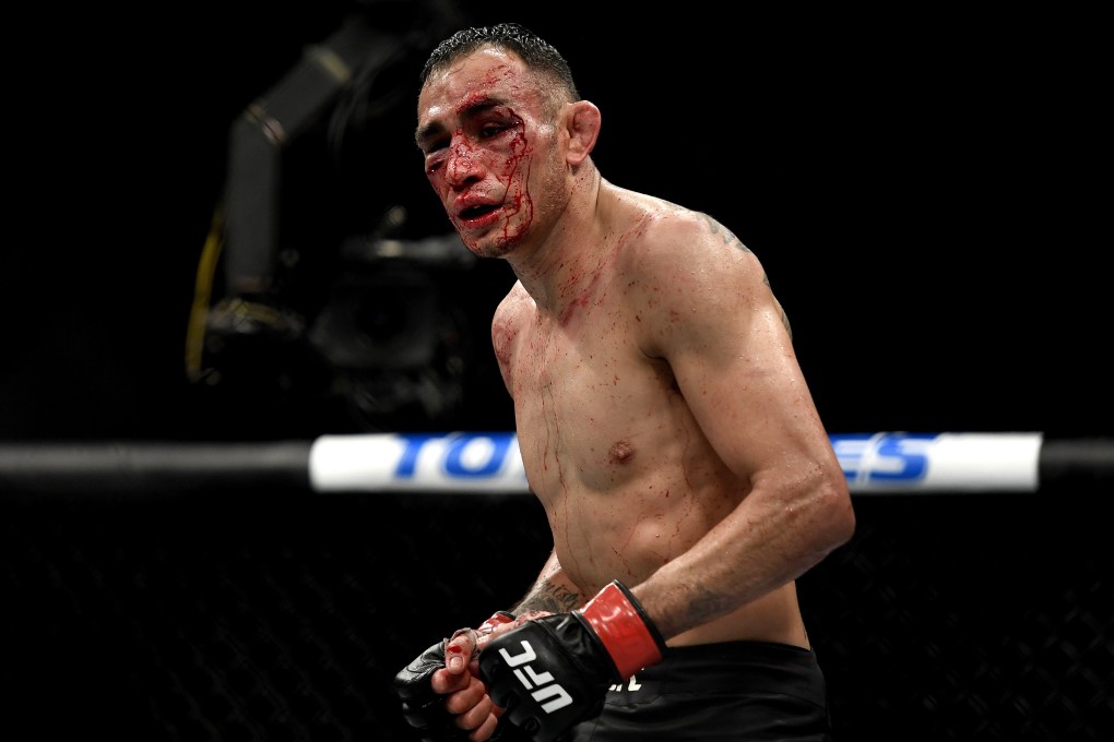 A bloodied Tony Ferguson at the end of his interim lightweight title fight against Justin Gaethje at UFC 249. Photo: AFP