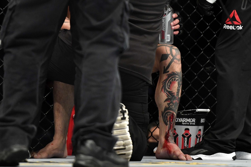 UFC veteran Gabriel Benitez suffers a shin injury during his fight against Omar Morales at UFC Fight Night in Florida. Photo: AFP