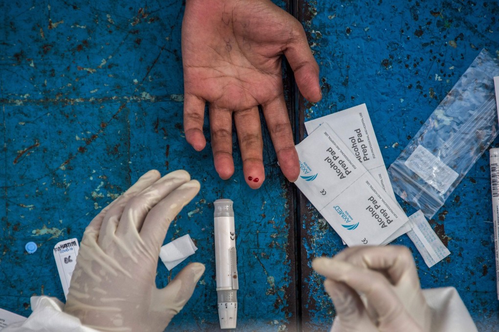 Singapore sees the availability of affordable, rapid test kits as key to a quick economic recovery. Photo: AFP
