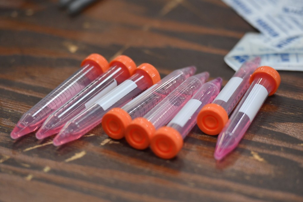The patient’s initial swabs tested negative for the coronavirus. Photo: AFP