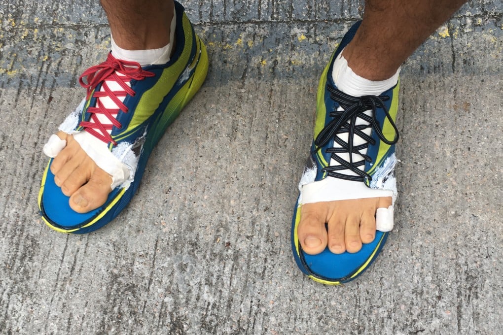 Phairat Varasin, a finisher of the 298km Hong Kong Four Trails Ultra Challenge, has modified his shoes for more toe room. Photo: Mark Agnew