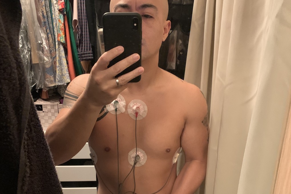 Fernando now uses a monitor to track his heart's rhythm.