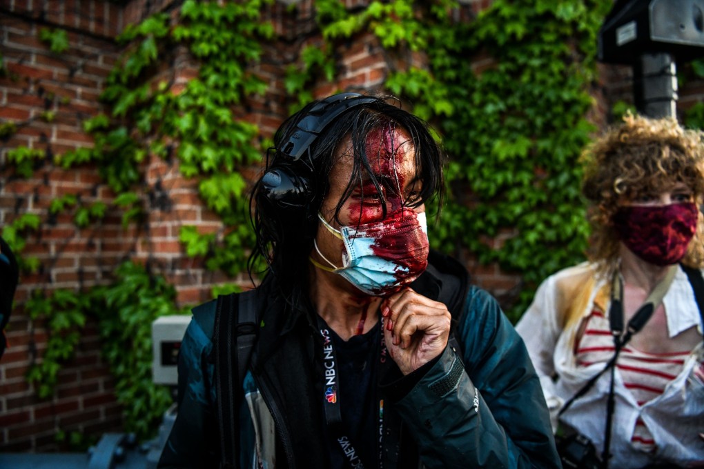 A journalist is seen bleeding after police started firing tear gas and rubber bullets near the 5th police precinct following a demonstration in Minneapolis, Minnesota. Photo: AFP