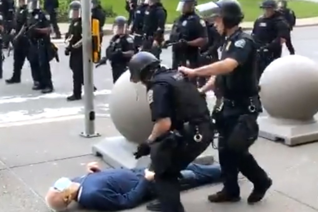 Donald Trump peddled another unfounded conspiracy theory, this time trying to raise suspicions about a 75-year-old protester who was hospitalised after being shoved by police. Photo: AP