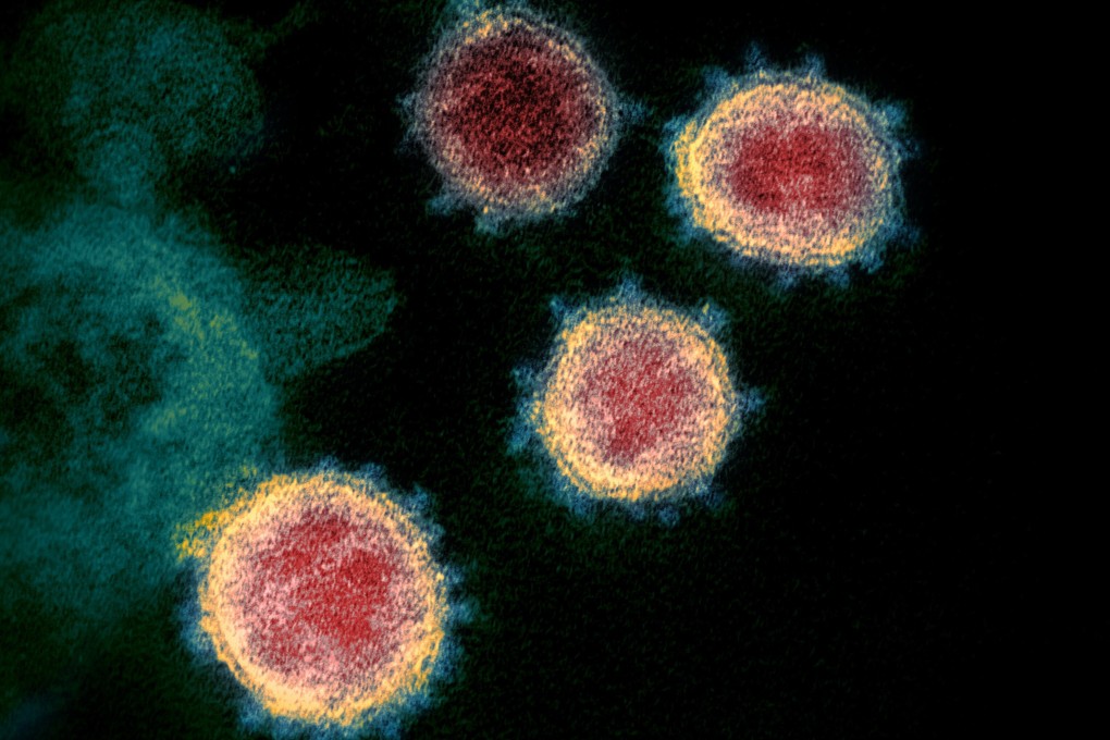 An electron microscope image shows the coronavirus that causes Covid-19. New research suggests that not everyone infected produces antibodies, or long-lasting ones. Photo: AP