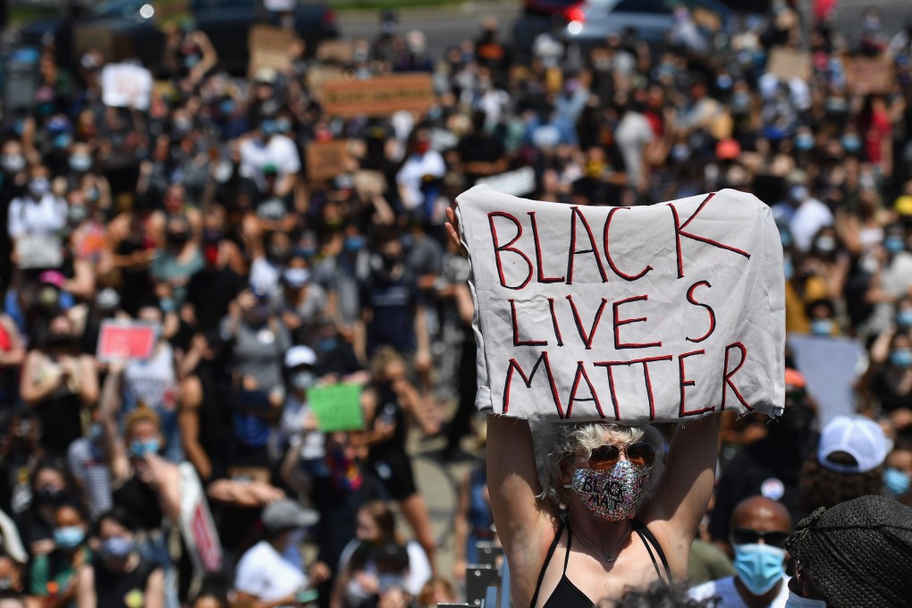 A protester holds a Black Lives Matter sign during a Juneteenth rally on June 19, 2020 in front of the Brooklyn Museum in New York City. Photo: AFP