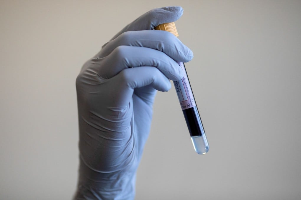 A blood sample is taken during a coronavirus antibody testing programme, as scientists race to find potential treatment options. Photo: Reuters