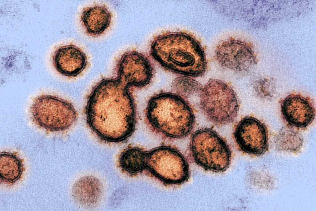 Older people and those with pre-existing conditions are at increased risk of becoming seriously ill from Covid-19, according to the WHO. Photo: EPA-EFE